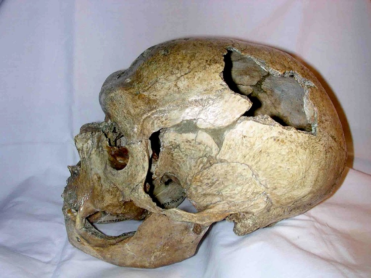 Crânio de Neandertal