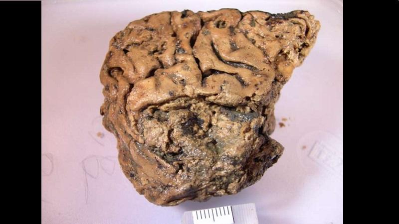 Cientistas tentam desvendar mistério de cérebro humano de 2600 anos bem preservado-0