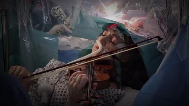 Paciente toca violino durante uma operação para a retirada de um tumor cerebral-0