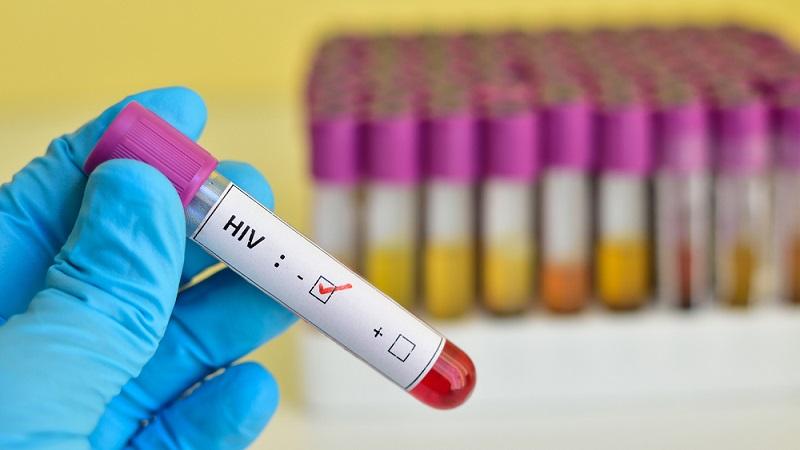 Médicos da Inglaterra anunciam segundo caso de cura de um paciente com HIV-0