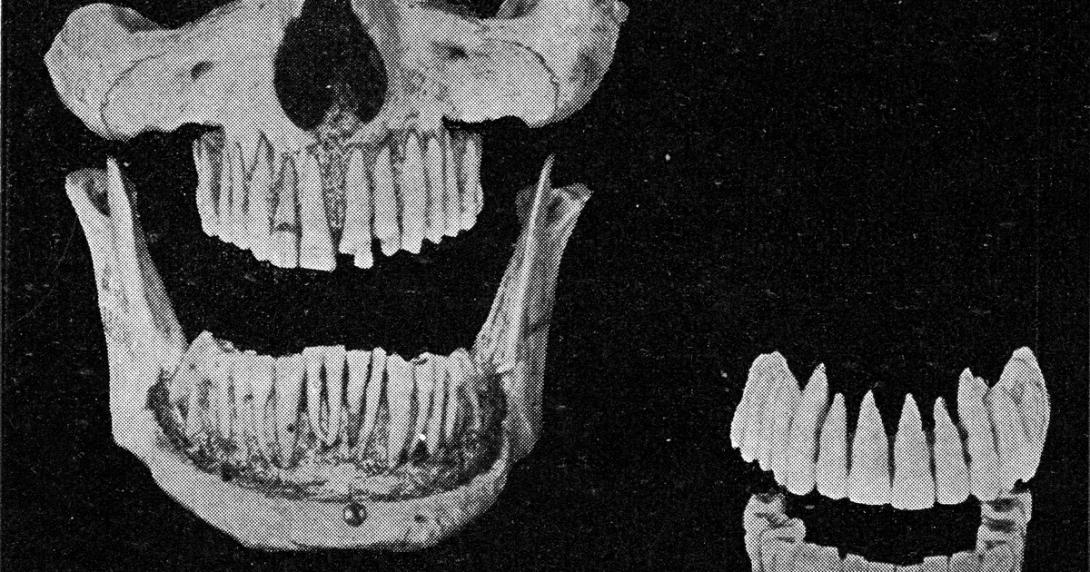 Novo estudo liga a origem do cálcio de nossos ossos e dentes à explosão de estrelas-0