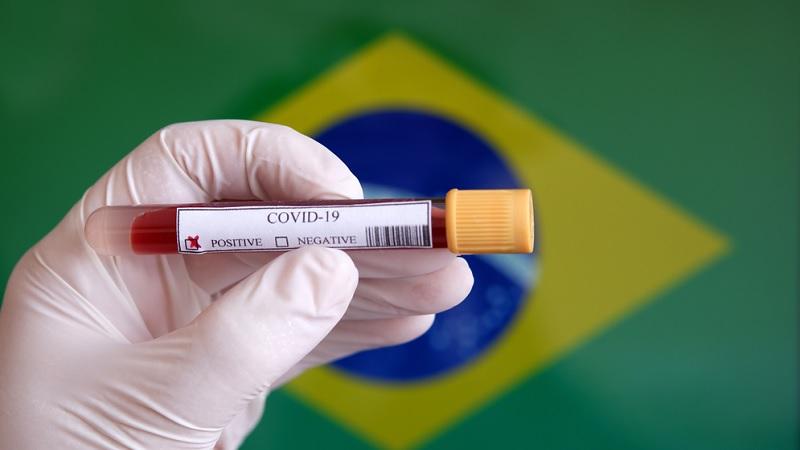 Primeiro caso de COVID-19 foi registrado há um ano no Brasil-0