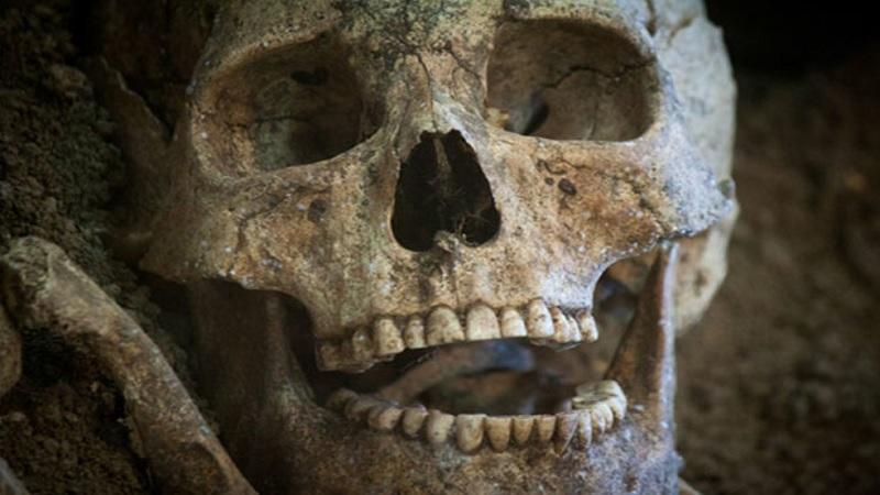 Dentes furados com pedras e obturações de alcatrão revelam como era a odontologia há 13 mil anos-0