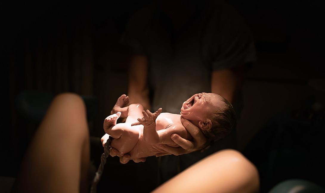 Bebê nasce com cauda de 12 centímetros com bola na ponta no Ceará-0