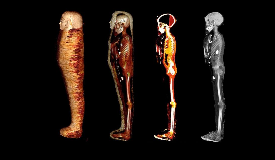 Análise da múmia do "menino de ouro" revela presença de 49 amuletos escondidos-0
