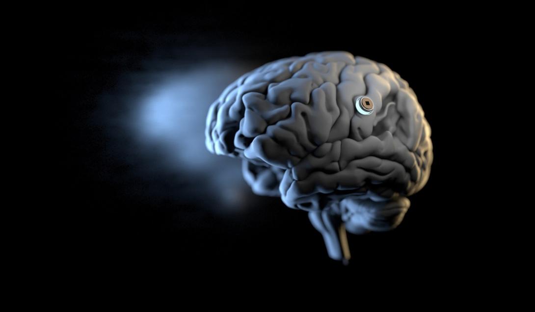 Elon Musk diz que primeiro humano recebeu implante cerebral da Neuralink-0