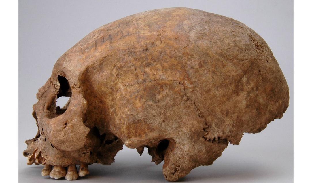 Descobertos os esqueletos de três mulheres vikings com crânios alongados-0